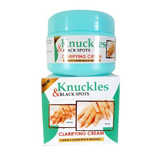 Dark Knuckles And Black Spots Clarifying Cream Clears Black Knuckles And Spots 1